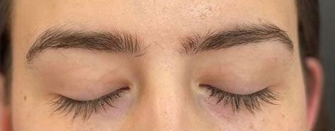 Both eyebrows before threading, unshaped